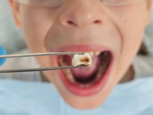 Best Urgent Tooth Repair  in Janesville, WI